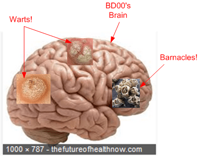 BD00 Brain